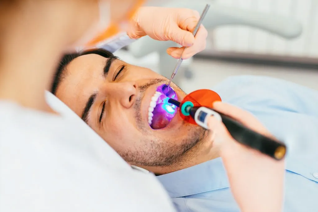 Dental Fillings at Tulip Dental Maplewood